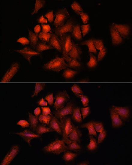 a06533 stam2 primary antiboties if testing 4