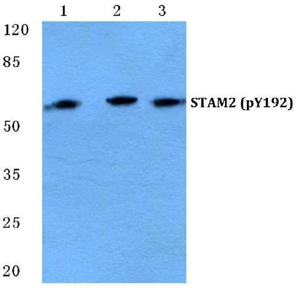 Western blot (WB) analysis of p-STAM2 (Y192) polyclonal antibody at 1:500 dilution
Lane1:HEK293T cell treated with EGF(0