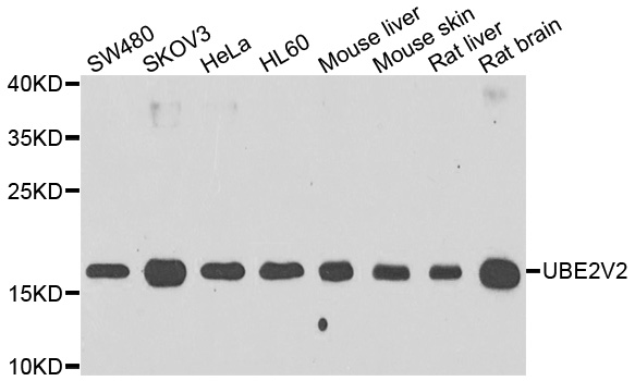 a06535 ube2v2 primary antiboties wb testing 1