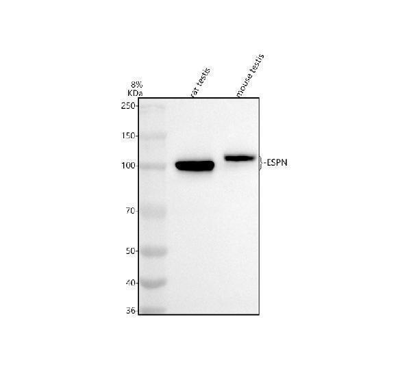  Western blot analysis of ESPN using anti-ESPN antibody (A06536)