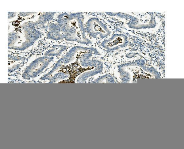a06539 2 atg4a primary antibodies ihc testing 2