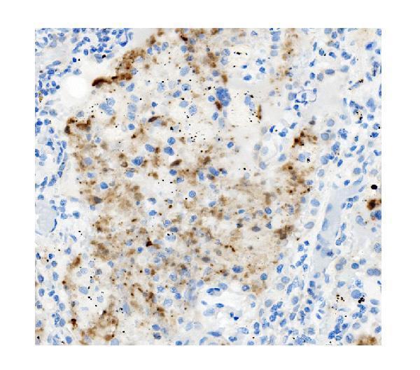 a06539 2 atg4a primary antibodies ihc testing 3