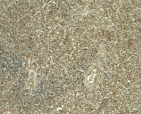 a06539 atg4a primary antibodies ihc testing 2