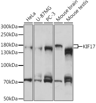 a06540 kif17 primary antiboties wb testing 1