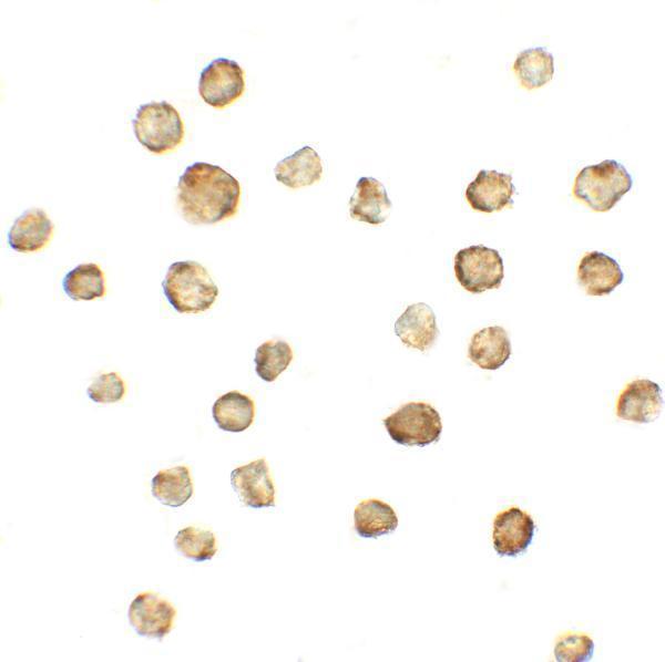 Immunocytochemistry of ATMIN in A431 cells with ATMIN antibody at 5 μg/mL