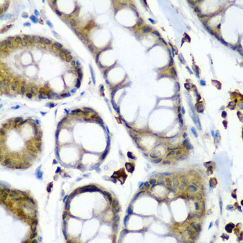 a06543 secisbp2 primary antiboties ihc testing 2