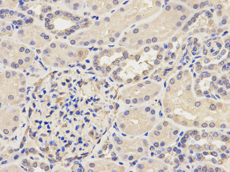a06544 1 ap2b1 primary antiboties ihc testing 2