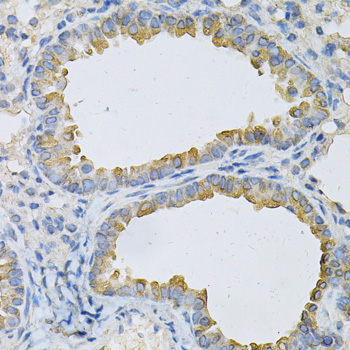 a06544 1 ap2b1 primary antiboties ihc testing 3