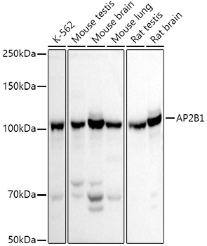 a06544 1 ap2b1 primary antiboties wb testing 1