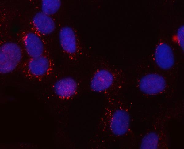a06545 snx6 primary antibodies if testing 2