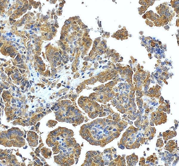 a06545 snx6 primary antibodies ihc testing 1