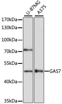 a06548 gas7 primary antiboties wb testing 1