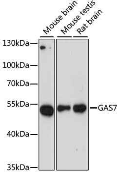 a06548 gas7 primary antiboties wb testing 2
