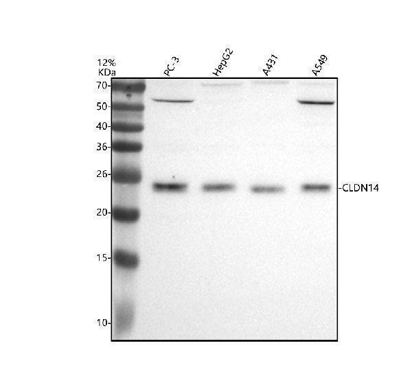 Western blot analysis of CLDN14 using anti-CLDN14 antibody (A06550-1)