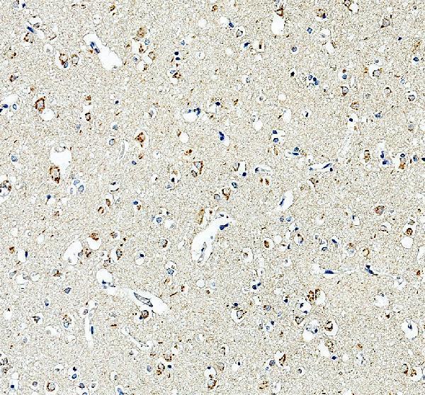 a06552 1 grm4 primary antibodies ihc testing 1