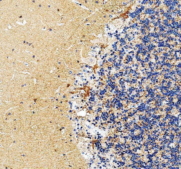 a06552 1 grm4 primary antibodies ihc testing 2