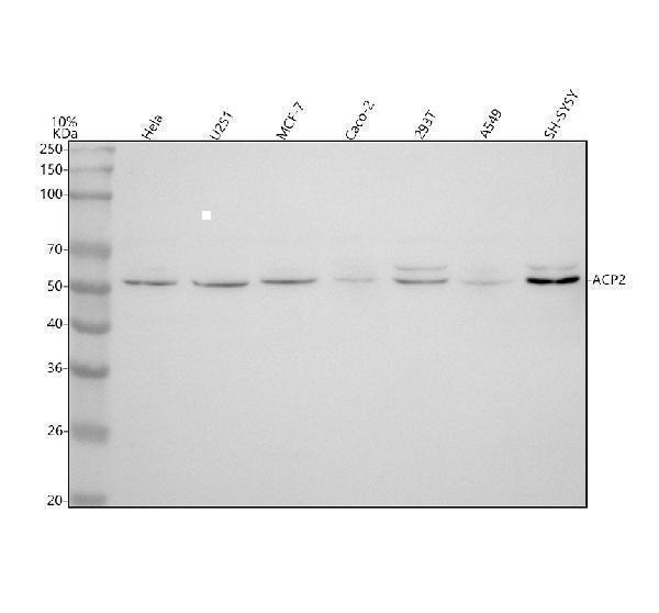  Western blot analysis of ACP2 using anti-ACP2 antibody (A06554-2)