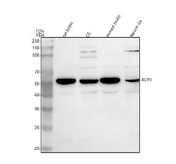  Western blot analysis of ACP2 using anti-ACP2 antibody (A06554-2)