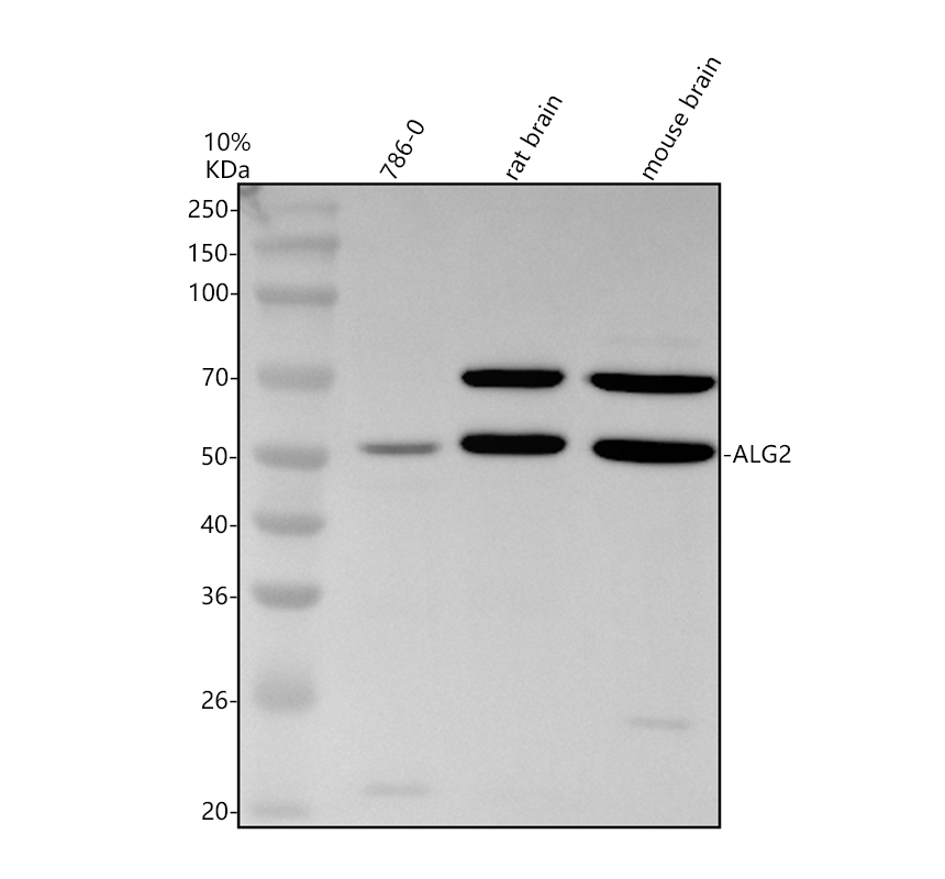 Western blot analysis of PDCD6/ALG2 using anti-PDCD6/ALG2 antibody (A06556-1)