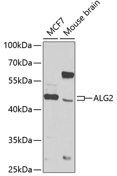 Western blot analysis of extracts of various cell lines, using ALG2 antibody  at 1:1000 dilution