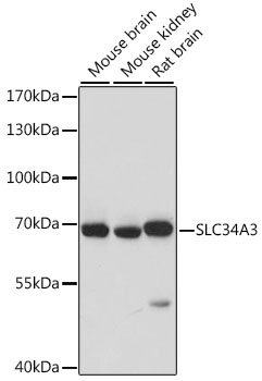 Western blot analysis of extracts of various cell lines, using SLC34A3 antibody  at 1:1000 dilution