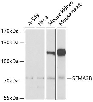 a06559 sema3b primary antiboties wb testing 1