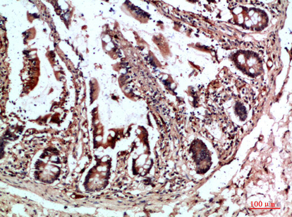 a06562 cyfip2 primary antibodies ihc testing 1