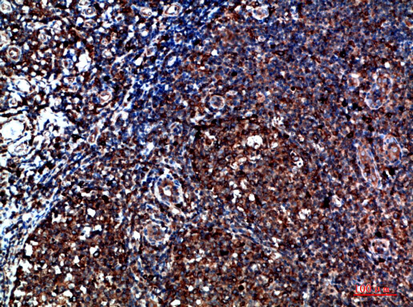Immunohistochemical analysis of paraffin-embedded human-tonsil, antibody was diluted at 1:200