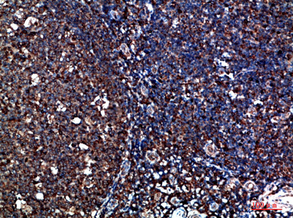 Immunohistochemical analysis of paraffin-embedded human-tonsil, antibody was diluted at 1:200