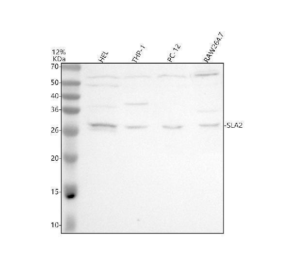 Western blot analysis of SLA2 using anti-SLA2 antibody (A06566-1)