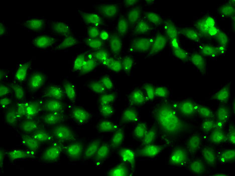 Immunofluorescence analysis of MCF7 cells using NR2C1 antibody 