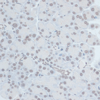 a06570 znf703 primary antiboties ihc testing 2