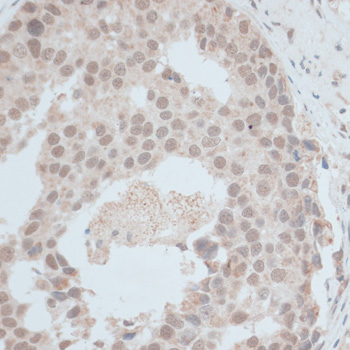 a06570 znf703 primary antiboties ihc testing 3