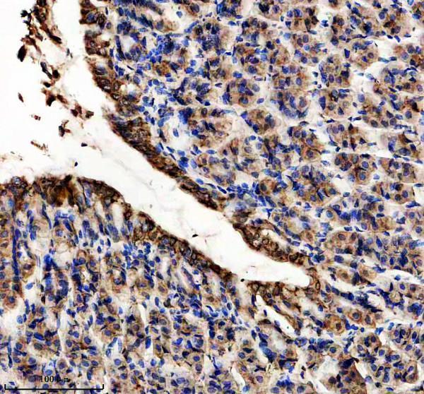 IHC analysis of LIPF using anti-LIPF antibody (A06572-2)