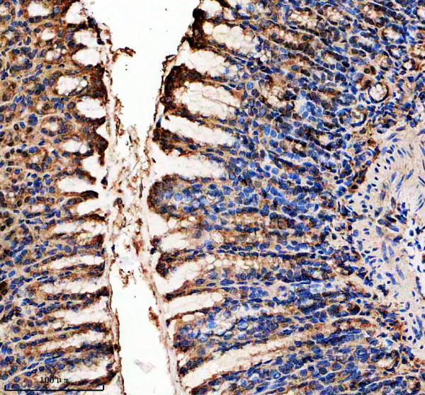 IHC analysis of LIPF using anti-LIPF antibody (A06572-2)