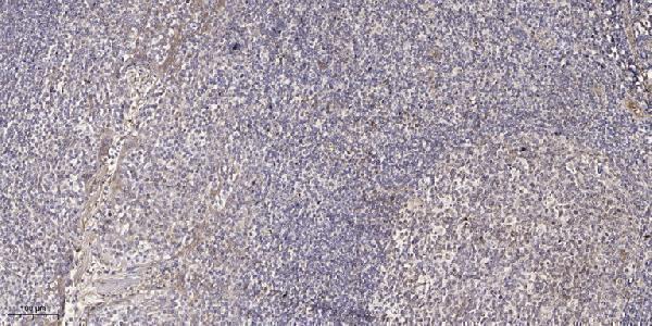 a06580 sh3tc2 primary antibodies ihc testing 1