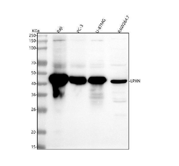  Western blot analysis of LPXN using anti-LPXN antibody (A06581)