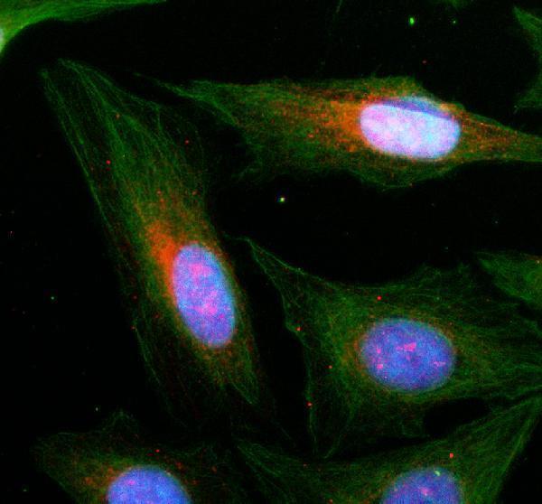 IF analysis of HHAT using anti-HHAT antibody (A06582-1) and anti-Alpha Tubulin antibody (M03989-3)