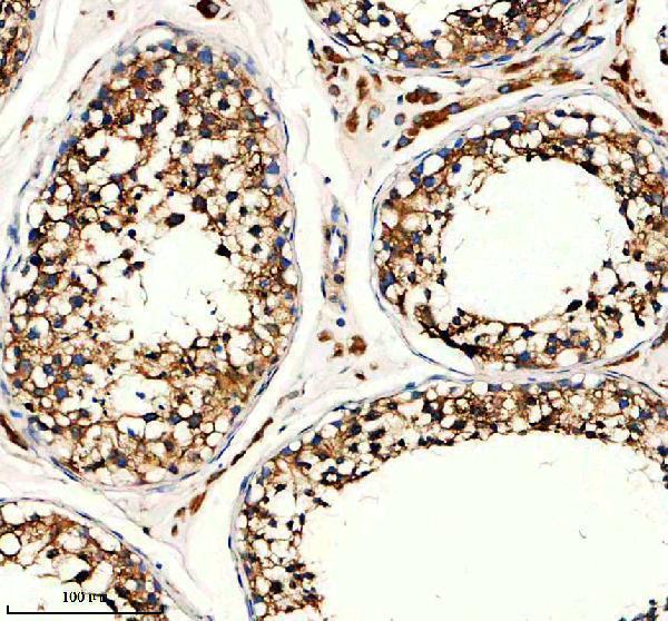 IHC analysis of HHAT using anti-HHAT antibody (A06582-1)
