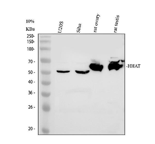 Western blot analysis of HHAT using anti-HHAT antibody (A06582-1)