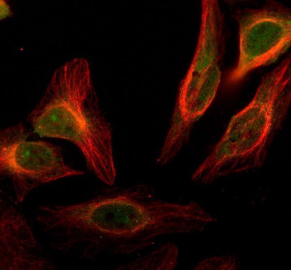 IF analysis of NCAM2 using anti-NCAM2 antibody (A06583-2) and anti-Beta Tubulin antibody (M01857-3)