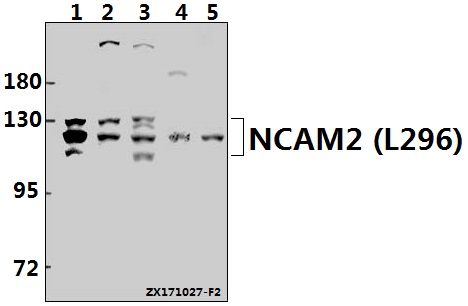 Western blot (WB) analysis of NCAM2 (L296) pAb at 1:500 dilution
Lane1:K562 whole cell lysate(40ug)
Lane2:MCF-7 whole cell lysate(40ug)
Lane3:Hela whole cell lysate(40ug)
Lane4:The Brain tissue lysate of Mouse(40ug)
Lane5:The Brain tissue lysate of Rat(40ug)