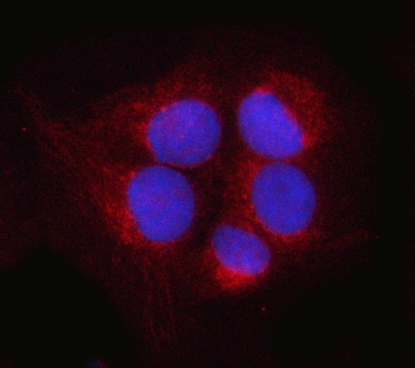 a06584 1 psmd14 primary antibodies if testing 10