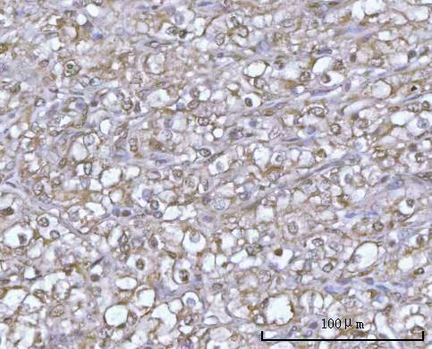  IHC analysis of POH1/PSMD14 using anti-POH1/PSMD14 antibody (A06584-1)