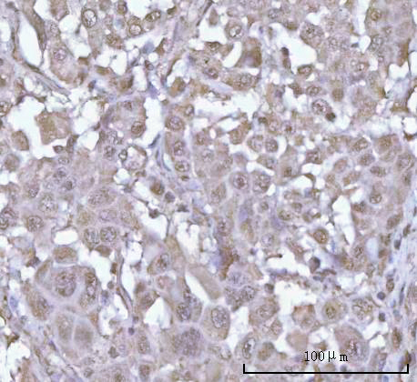  IHC analysis of POH1/PSMD14 using anti-POH1/PSMD14 antibody (A06584-1)