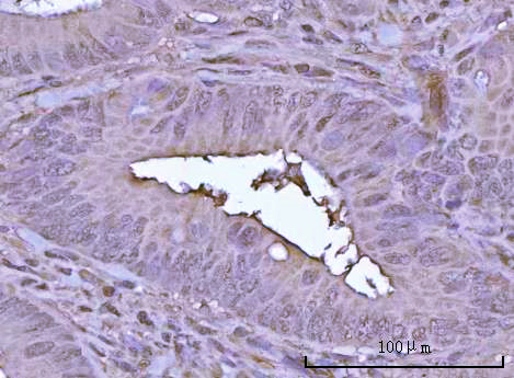 a06584 1 psmd14 primary antibodies ihc testing 4