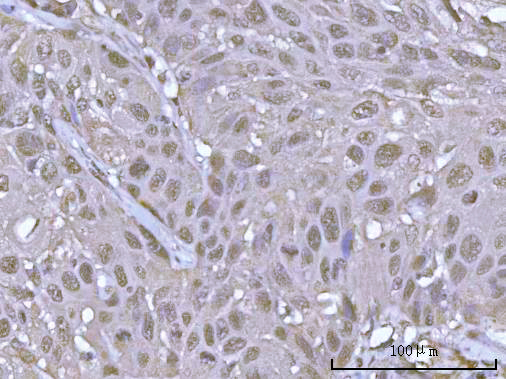 a06584 1 psmd14 primary antibodies ihc testing 5