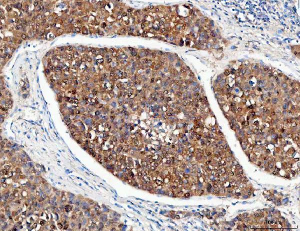 a06584 1 psmd14 primary antibodies ihc testing 6