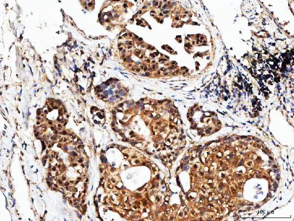 a06584 1 psmd14 primary antibodies ihc testing 7