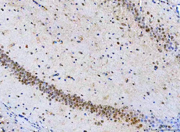 a06584 1 psmd14 primary antibodies ihc testing 8